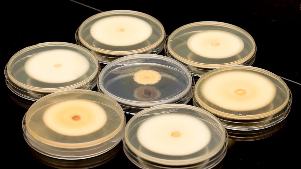 Contaminación en cultivo in vitro: las seis causas que explican el 90% de los casos